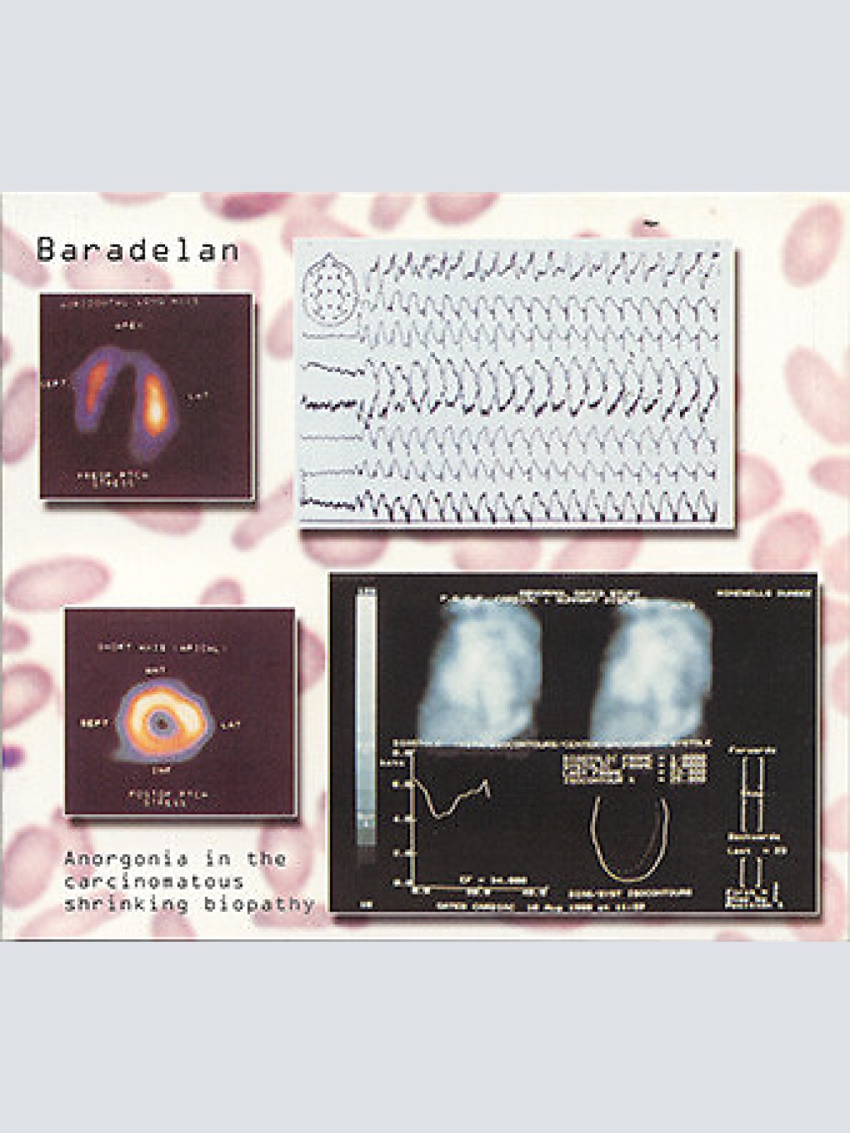 CDr, Album, Ltd Baradelan - Anorgonia In The Carcinomatous Shrinking Biopathy